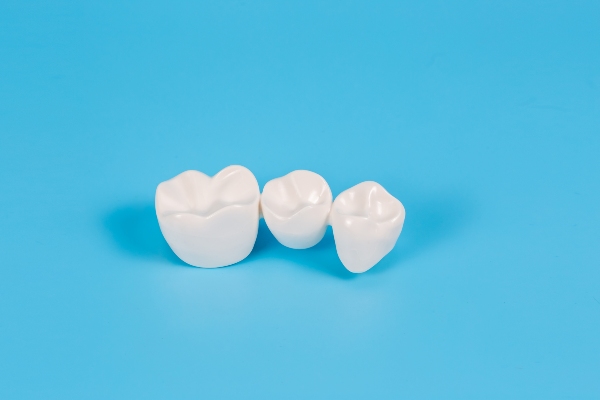 Protect And Preserve: The Role Of Dental Crowns In Oral Health