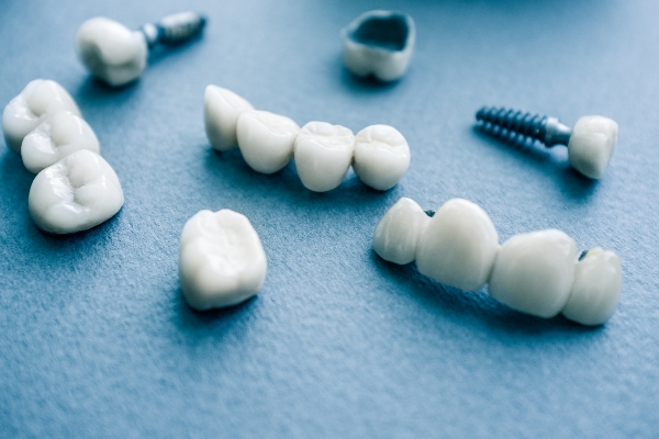 Understanding The Difference Between Porcelain And PFM Dental Crowns
